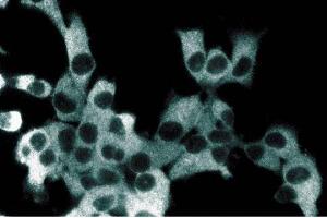 Immunofluorescent staining of ES2 cells with anti-IKKgamma antibody. (IKBKG anticorps  (AA 278-396))