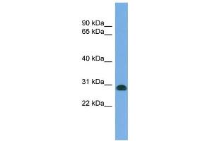 WB Suggested Anti-CENPH Antibody Titration: 0. (CENPH anticorps  (N-Term))