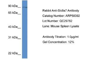 Western Blotting (WB) image for anti-Sodium Hydrogen Exchanger 7 (SLC9A7) (C-Term) antibody (ABIN2787660) (NHE7 anticorps  (C-Term))