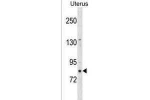 ZN Antibody (N-term) (ABIN1539004 and ABIN2850297) western blot analysis in Uterus tissue lysates (35 μg/lane). (ZNF853 anticorps  (N-Term))