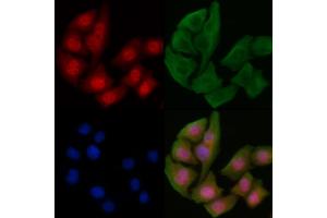 ABIN6255040 and ABIN6267230 staining Hela cells by IF/ICC. (IKK-alpha /IKK-beta anticorps  (pSer180, pSer181))