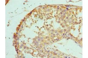 Immunohistochemistry of paraffin-embedded human testis tissue using ABIN7150715 at dilution of 1:100 (MAP2K5 anticorps  (AA 1-190))