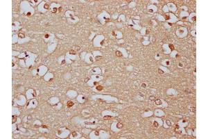 IHC image of ABIN7166521 diluted at 1:300 and staining in paraffin-embedded human brain tissue performed on a Leica BondTM system. (PCDHa8 anticorps  (AA 719-922))