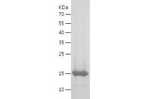 Western Blotting (WB) image for Calprotectin (S100A8/A9) (AA 1-119) protein (His tag) (ABIN7122108)