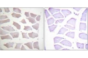 Immunohistochemistry analysis of paraffin-embedded human skeletal muscle tissue, using CRYAB (Ab-19) Antibody. (CRYAB anticorps  (AA 10-59))