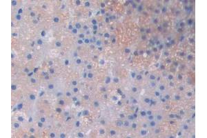 Used in DAB staining on fromalin fixed paraffin- embedded skeletal muscle tissue