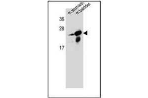 Western blot analysis of RAB25 Antibody (Center) in mouse stomach,bladder tissue lysates (35ug/lane).
