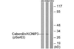 Immunohistochemistry analysis of paraffin-embedded human brain tissue using Calsenilin/KCNIP3 (Phospho-Ser63) antibody. (DREAM anticorps  (pSer63))