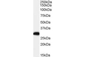Image no. 1 for anti-EF-Hand Domain Family, Member D2 (EFHD2) (C-Term) antibody (ABIN374490) (EFHD2 anticorps  (C-Term))