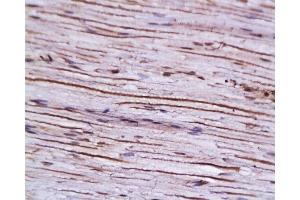 Formalin-fixed and paraffin embedded: rat sciatic nerve labeled with Anti-AGER/RAGE Polyclonal Antibody, Unconjugated  at 1:200 followed by conjugation to the secondary antibody and DAB staining