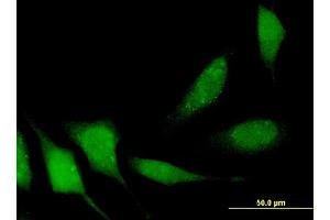 Immunofluorescence of monoclonal antibody to APPL2 on HeLa cell.