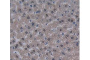 Used in DAB staining on fromalin fixed paraffin- embedded liver tissue (DKC1 anticorps  (AA 298-509))