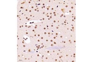 Immunohistochemistry of paraffin embedded mouse brain using USP34 (ABIN7076115) at dilution of 1:700 (400x lens)