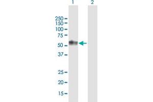 Western Blot analysis of TNFRSF1A expression in transfected 293T cell line by TNFRSF1A MaxPab polyclonal antibody.