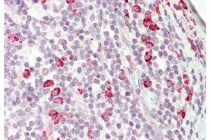 Rabbit Anti-KIAA0317 antibody  Formalin Fixed Paraffin Embedded Tissue: Human Tonsil Primary antibody Concentration: 1:100 Secondary Antibody: Donkey anti-Rabbit-Cy3 Secondary Antibody Concentration: 1:200 Magnification: 20x Exposure Time: 0. (AREL1 anticorps  (N-Term))