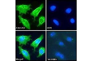 ABIN6391344 Immunofluorescence analysis of paraformaldehyde fixed HepG2 cells, permeabilized with 0. (CTGF anticorps  (Internal Region))