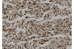 ABIN6272402 at 1/100 staining Human lung tissue by IHC-P. (PSKH1 anticorps  (Internal Region))