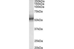 AP31785PU-N TRIM11 antibody staining of Human spleen lysate at 0. (TRIM11 anticorps  (Internal Region))