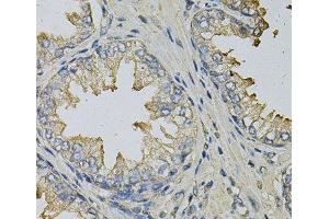 Immunohistochemistry of paraffin-embedded Human prostate using LITAF Polyclonal Antibody at dilution of 1:100 (40x lens). (LITAF anticorps)