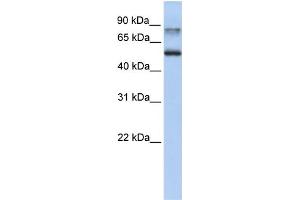 WB Suggested Anti-EPN1 Antibody Titration: 0. (Epsin 1 anticorps  (C-Term))