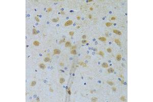 Immunohistochemistry of paraffin-embedded rat brain using CHIA Antibody. (CHIA anticorps  (AA 1-368))