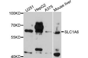 Western blot analysis of extracts of various cells, using SLC1A6 antibody. (SLC1A6 anticorps)