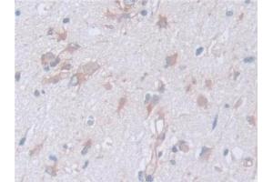 Detection of CAPNS1 in Human Cerebrum Tissue using Polyclonal Antibody to Calpain, Small Subunit 1 (CAPNS1) (Calpain S1 anticorps  (AA 1-268))