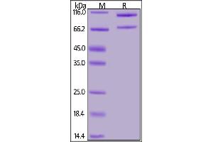 Mouse Complement C5, His Tag on  under reducing (R) condition.
