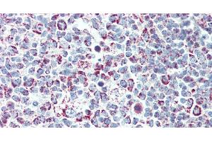 Immunohistochemistry of paraffin-embedded Tonsil tissue using LTB Polyclonal Antibody at dilution of 1:90. (LTB anticorps)