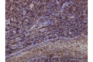 anti-Emerin (EMD) (AA 1-110) antibody