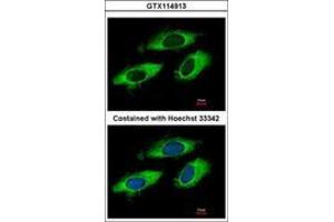 Image no. 3 for anti-Ribosomal Protein L6 (RPL6) (AA 7-223) antibody (ABIN1500745)