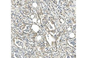 IHC analysis of CDR2 using anti-CDR2 antibody (ABIN7599397). (CDR2 anticorps  (AA 1-441))