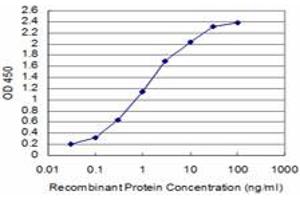 Detection limit for recombinant GST tagged SIX4 is approximately 0. (SIX4 anticorps  (AA 672-780))