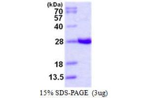 Image no. 1 for Glutathione S-Transferase alpha 4 (GSTA4) protein (His tag) (ABIN1098254) (GSTA4 Protein (His tag))