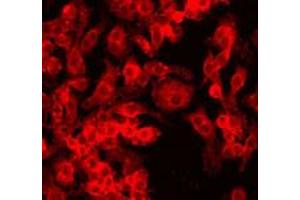 Staining of HIF1A (red dye 568) in a cultured Raw 264. (HIF1A anticorps  (AA 329-530))