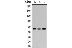 Western blot analysis of GABRR1 expression in HEK293T (A), Raw264.