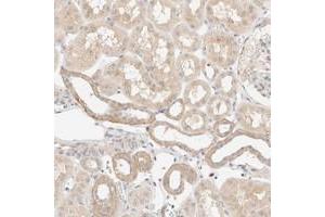 Immunohistochemical staining of human kidney with SNTB1 polyclonal antibody  shows weak cytoplasmic positivity in tubular cells at 1:10-1:20 dilution.