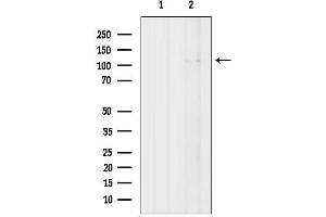 anti-Thyroid Hormone Receptor Associated Protein 3 (THRAP3) (N-Term) antibody