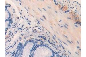 Detection of MYL3 in Mouse Rectum Tissue using Polyclonal Antibody to Myosin Light Chain 3, Alkali, Ventricular, Slow Skeletal (MYL3) (MYL3/CMLC1 anticorps  (AA 8-199))