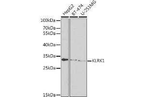 Western blot analysis of extracts of various cell lines, using KLRK1 antibody (ABIN6130074, ABIN6142979, ABIN6142980 and ABIN6221720) at 1:1000 dilution.