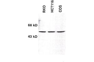 Image no. 1 for anti-Checkpoint Kinase 1 (CHEK1) (AA 1-474) antibody (ABIN264916) (CHEK1 anticorps  (AA 1-474))