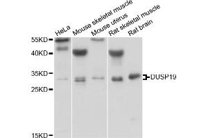 Western blot analysis of extracts of various cell lines, using DUSP19 antibody (ABIN1882354) at 1:1000 dilution. (DUSP19 anticorps)