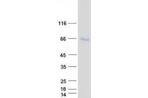 Validation with Western Blot