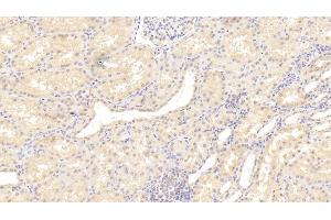 Detection of MGEA5 in Human Kidney Tissue using Polyclonal Antibody to Meningioma Expressed Antigen 5 (MGEA5)