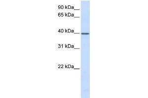 WB Suggested Anti-TCEA3 Antibody Titration:  0. (TCEA3 anticorps  (N-Term))