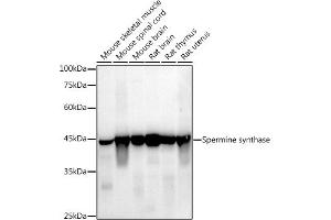 Western blot analysis of extracts of various cell lines, using (ABIN7270529) at 1:1000 dilution. (SMS anticorps)