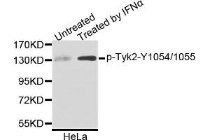 Western blot analysis of extracts of HeLa cells, using Phospho-Tyk2-Y1054/1055 antibody. (TYK2 anticorps)