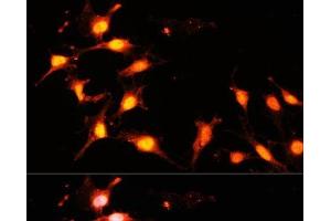 Immunofluorescence analysis of C6 cells using KAT2A Polyclonal Antibody at dilution of 1:100 (40x lens).