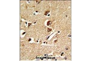 Formalin-fixed and raffin-embedded human brain tissue reacted with GNT Antibody (C-term), which was peroxidase-conjugated to the secondary antibody, followed by DAB staining.