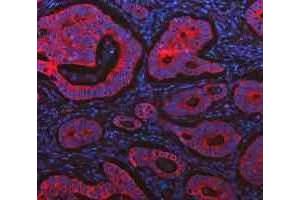 IF analysis of Cytokeratin 20/Krt20 using anti-Cytokeratin 20/Krt20 antibody (ABIN7601133). (KRT20 anticorps  (AA 29-431))